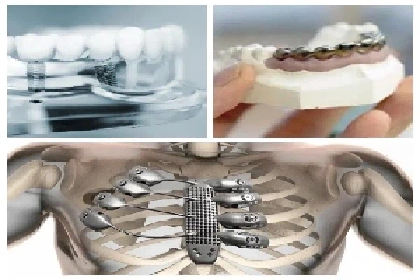 Gr23 titanium plates in medical industry Gr23 titanium plates in medical industry